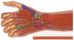 Hand Skeleton, Lifespan Cobre research